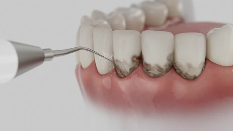 Trusted Wisdom Tooth Removal service in Halls, TN - Dentist Open Now